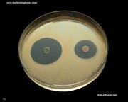 antibiotics susceptible bacterium(bacteria)